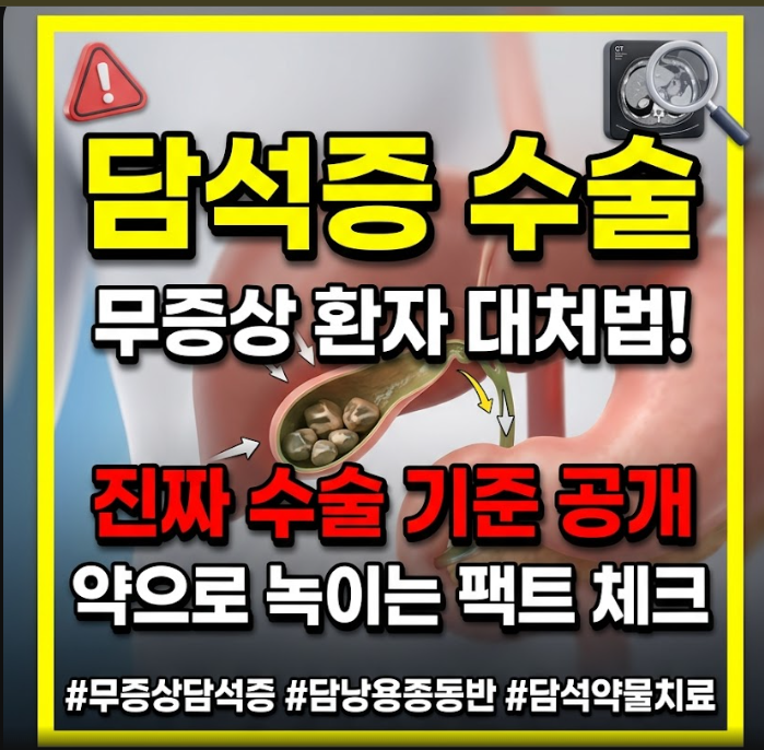 담석증 수술
